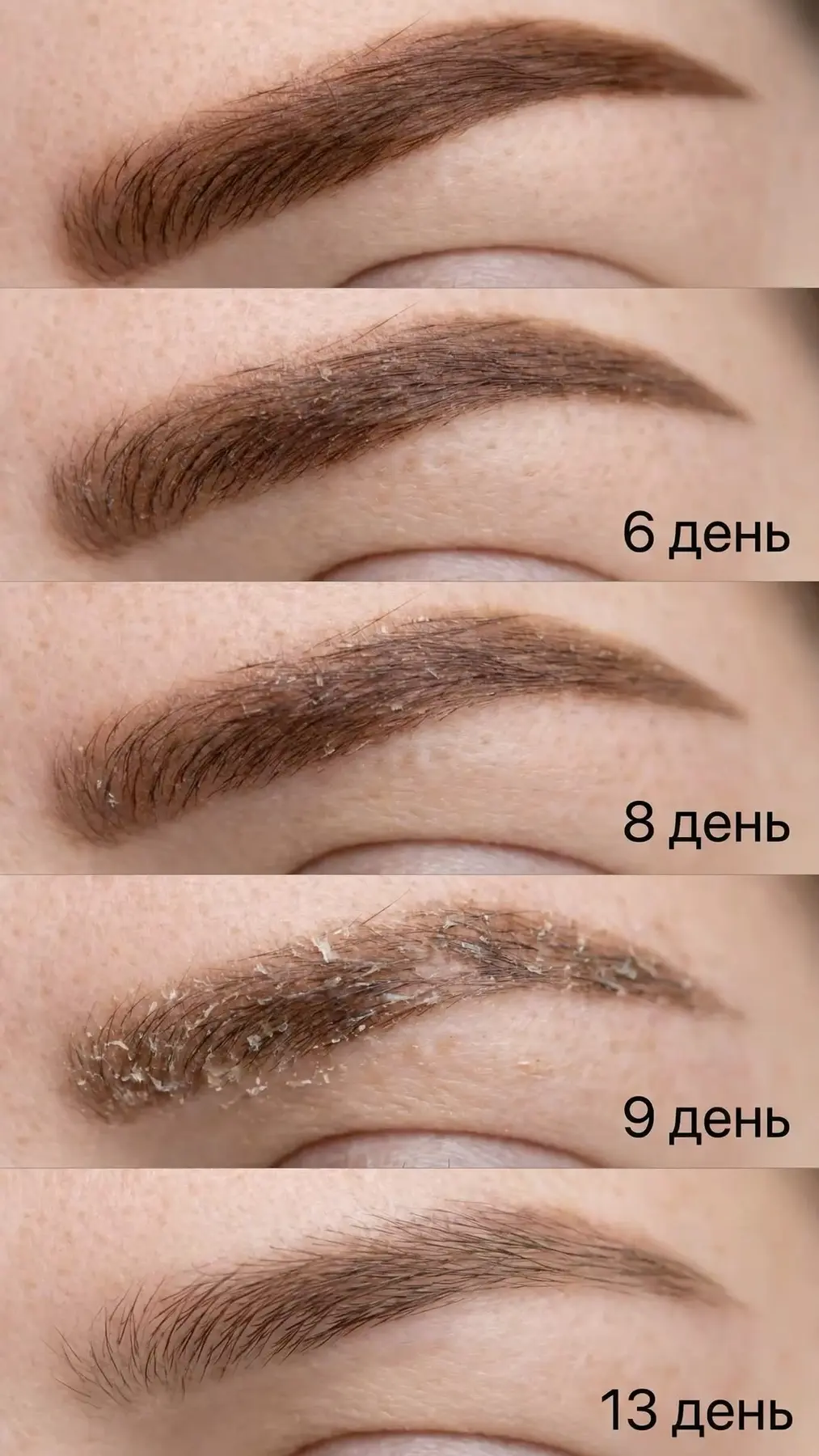 Изменение пигмента в период заживления